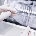 What Does an Oral Medicine Specialist Do Differently from a General Dentist?
