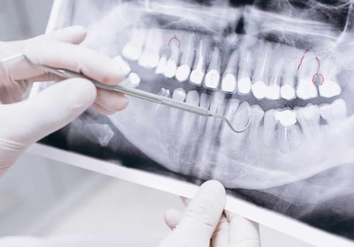 What Does it Mean to be a General Dentist?